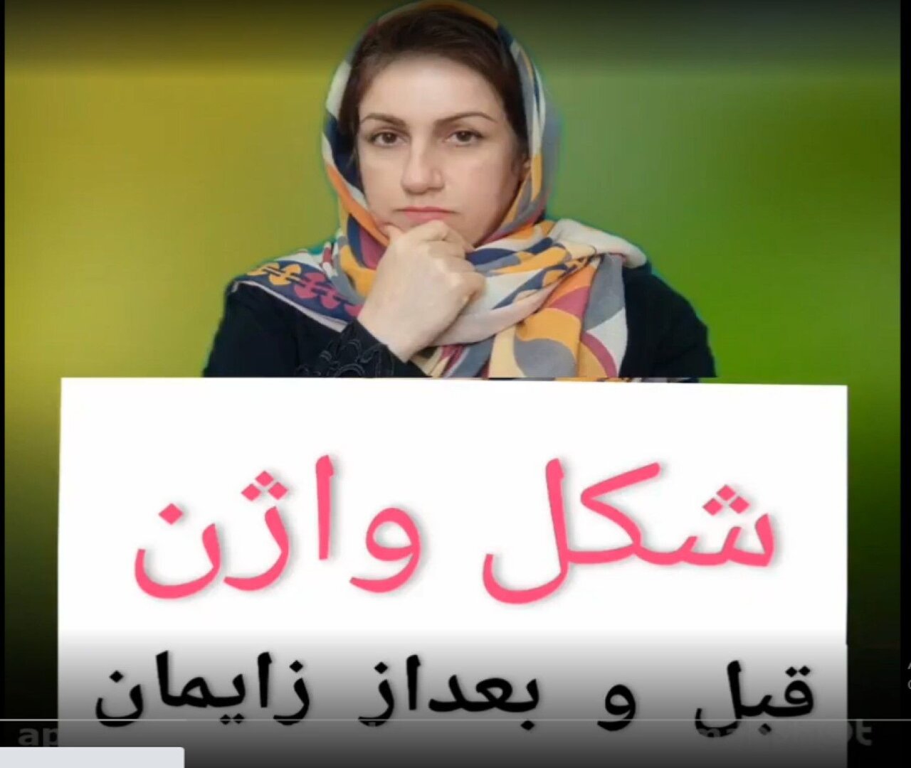 شکل واژن بعد از زایمان و راه درمان